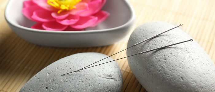 Acupuncture for head aches